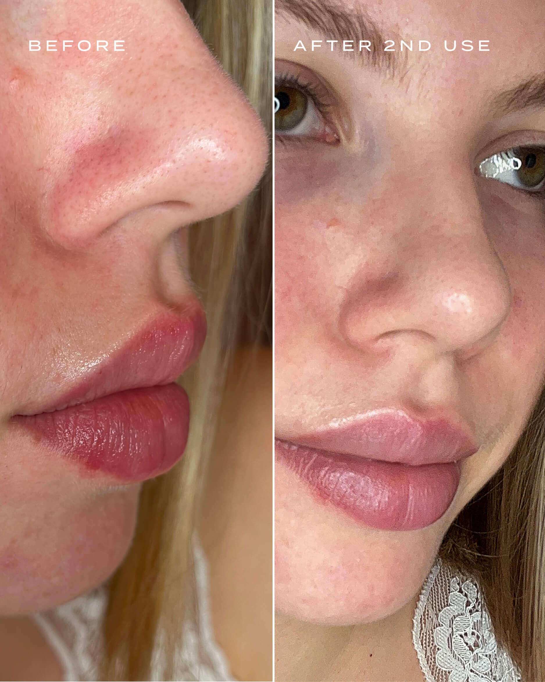 Magic Nose Pore Cleansers